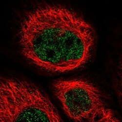 ZNF529 Antibody, Novus Biologicals 0.1mL; Unlabeled:Antibodies, Polyclonal
